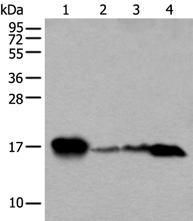 Rabbit Polyclonal Antibody to MB