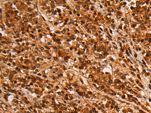 Rabbit Polyclonal Antibody to GRK5