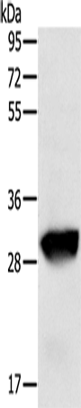 Rabbit Polyclonal Antibody to GSTO1