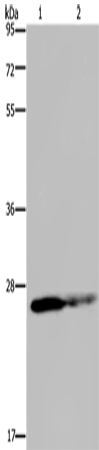Rabbit Polyclonal Antibody to GSTP1