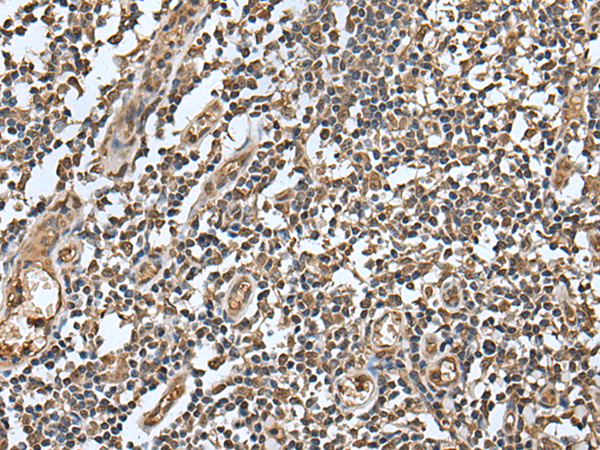 Rabbit Polyclonal Antibody to LAMTOR5