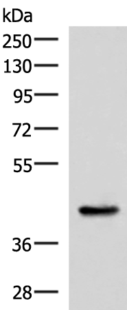 Rabbit Polyclonal Antibody to HPN