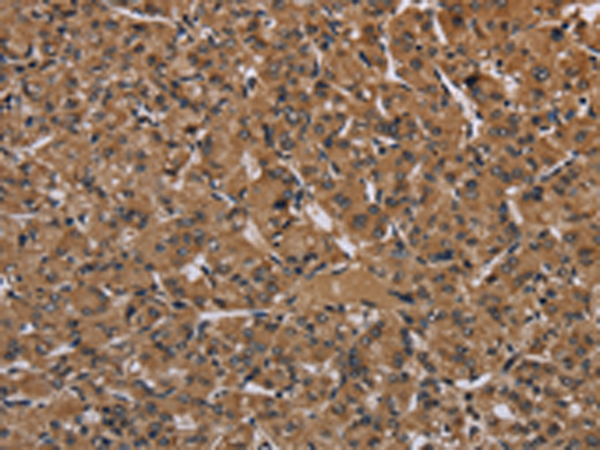 Rabbit Polyclonal Antibody to HIF1A