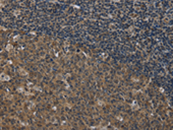 Rabbit Polyclonal Antibody to SETD7