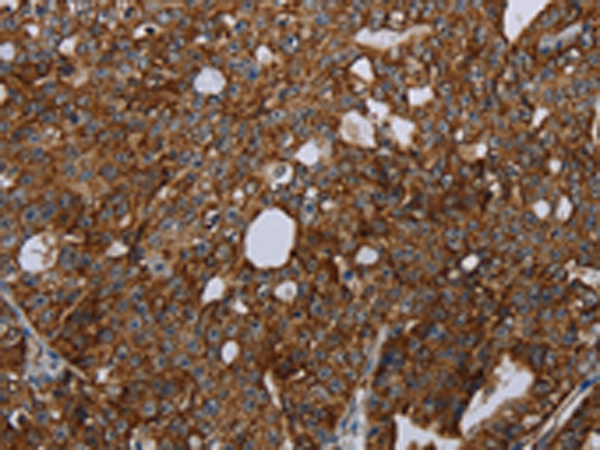Rabbit Polyclonal Antibody to HMGCR