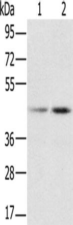 Rabbit Polyclonal Antibody to RBMX