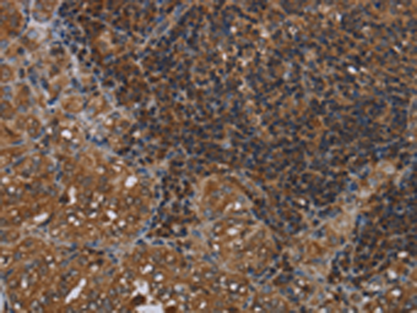 Rabbit Polyclonal Antibody to HOMER2