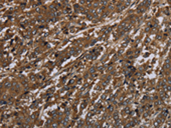 Rabbit Polyclonal Antibody to HPGD