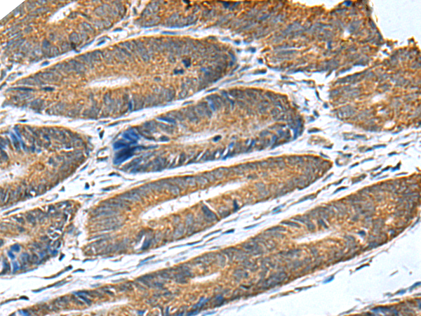Rabbit Polyclonal Antibody to HSD11B1