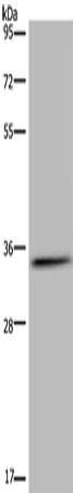 Rabbit Polyclonal Antibody to HSD17B7