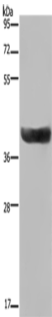 Rabbit Polyclonal Antibody to HSD17B2
