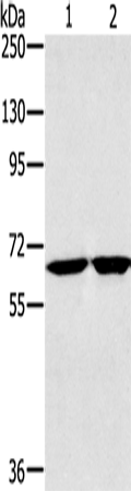 Rabbit Polyclonal Antibody to HSD17B4