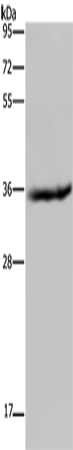Rabbit Polyclonal Antibody to HSD17B6