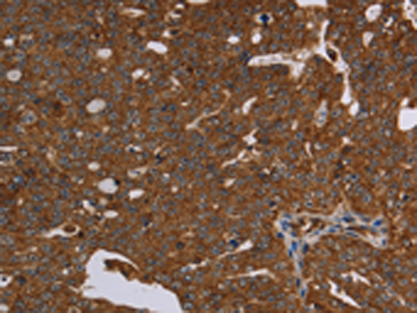Rabbit Polyclonal Antibody to HSD17B13