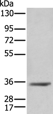 Rabbit Polyclonal Antibody to AKR1C4
