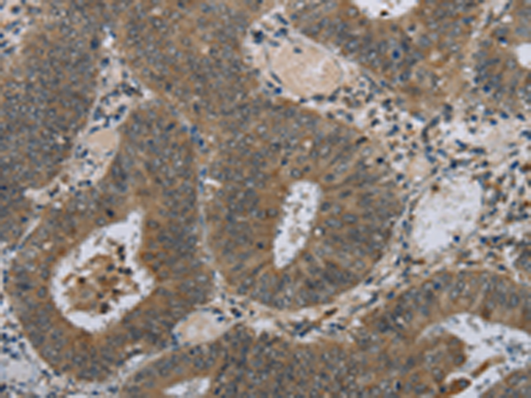 Rabbit Polyclonal Antibody to HSD3B1
