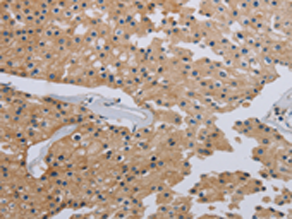 Rabbit Polyclonal Antibody to HSD3B7