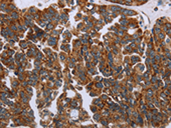 Rabbit Polyclonal Antibody to HSD3B2