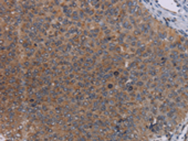 Rabbit Polyclonal Antibody to LIPE