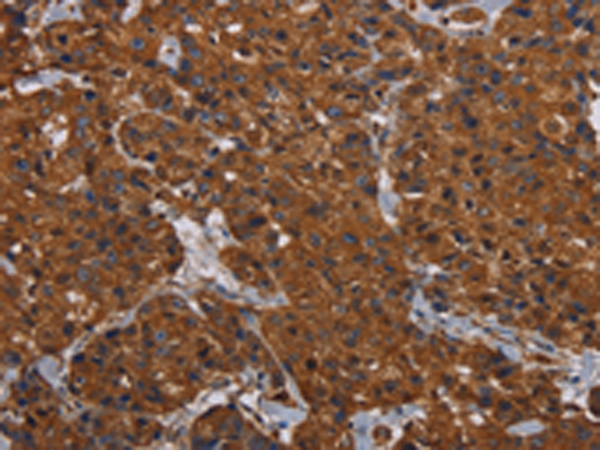 Rabbit Polyclonal Antibody to HYAL2