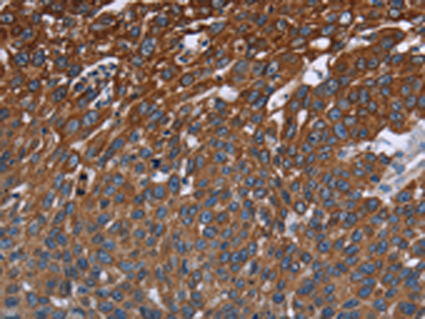 Rabbit Polyclonal Antibody to FCGR3A