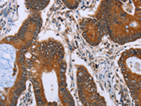 Rabbit Polyclonal Antibody to IHH