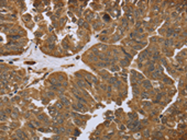 Rabbit Polyclonal Antibody to IKBIP