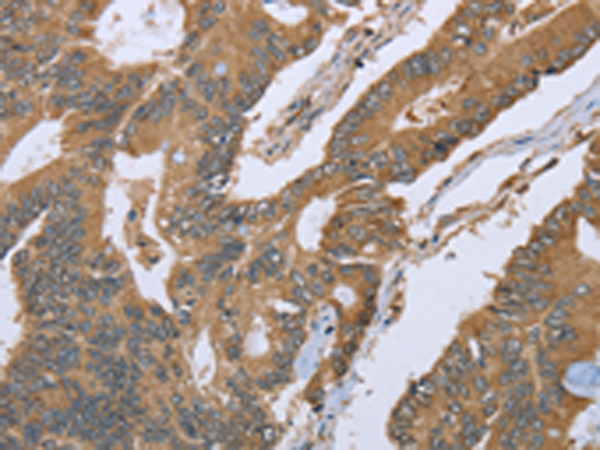 Rabbit Polyclonal Antibody to IL1RN