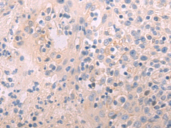 Rabbit Polyclonal Antibody to IL22RA2