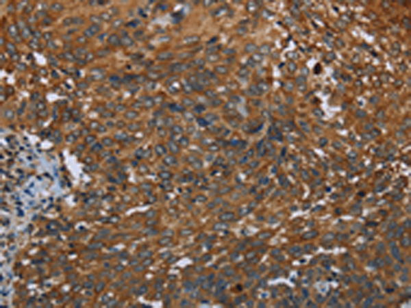 Rabbit Polyclonal Antibody to IL2RG