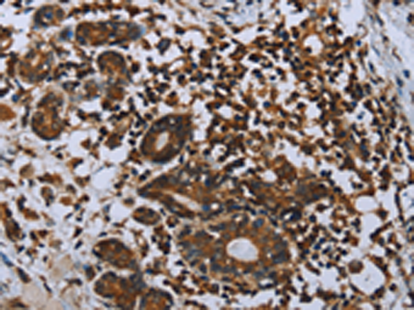 Rabbit Polyclonal Antibody to IL31RA