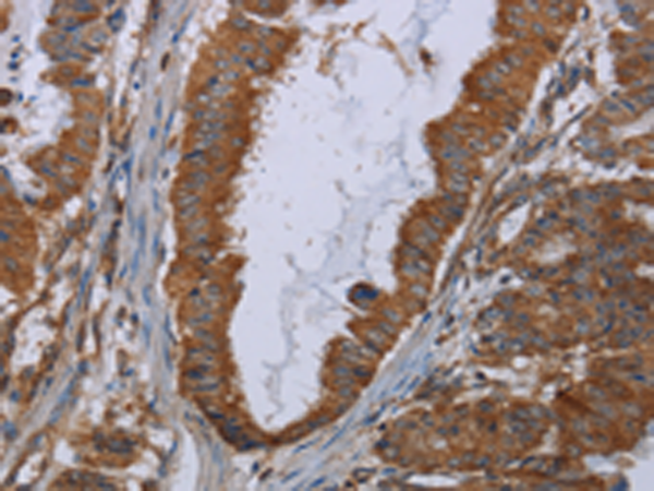 Rabbit Polyclonal Antibody to INSIG2