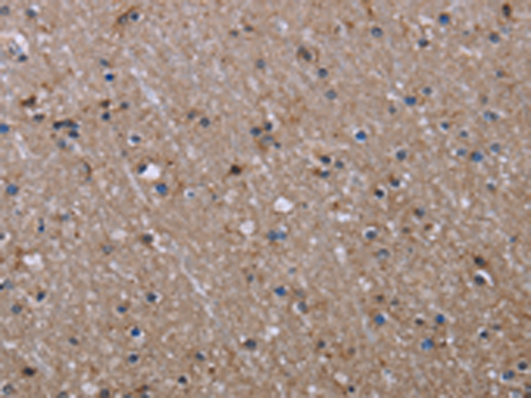 Rabbit Polyclonal Antibody to ITGB2