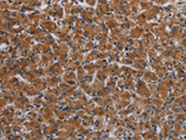 Rabbit Polyclonal Antibody to IRGM