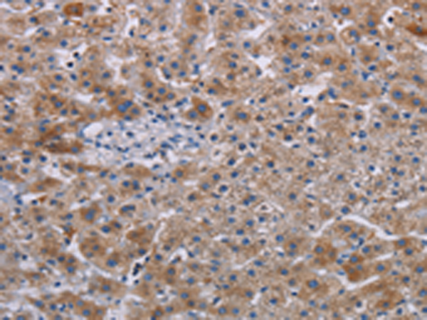 Rabbit Polyclonal Antibody to JAKMIP2