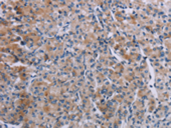 Rabbit Polyclonal Antibody to KDM4D