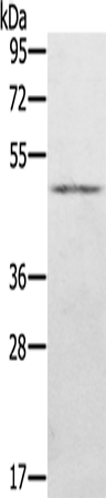 Rabbit Polyclonal Antibody to KDM8