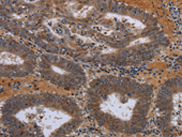 Rabbit Polyclonal Antibody to JMJD7