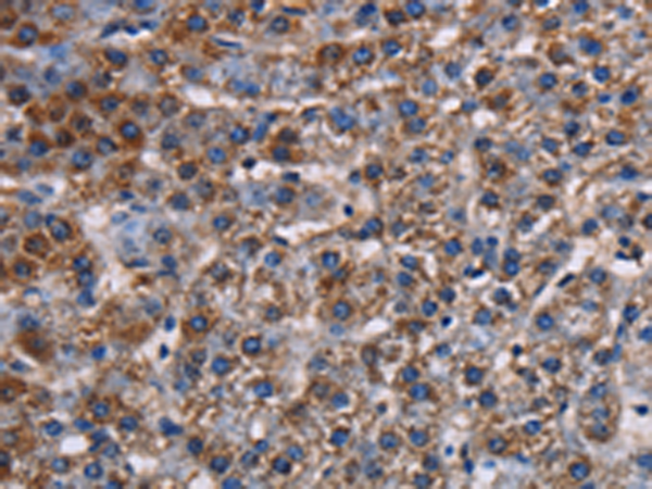 Rabbit Polyclonal Antibody to KCNK1