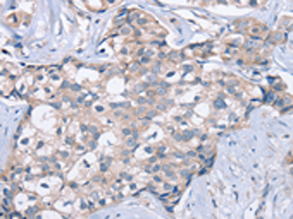 Rabbit Polyclonal Antibody to KCNQ5
