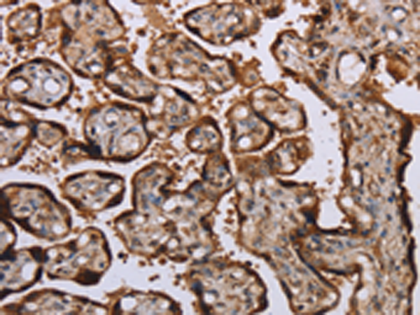 Rabbit Polyclonal Antibody to KIF1C