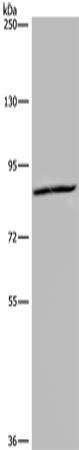 Rabbit Polyclonal Antibody to KIF2A