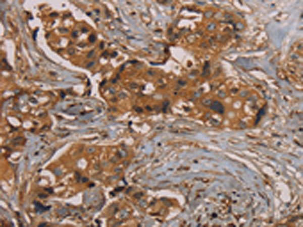 Rabbit Polyclonal Antibody to KIF20A