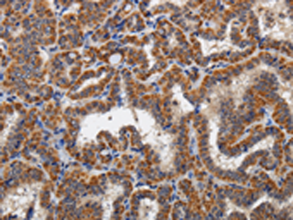 Rabbit Polyclonal Antibody to KLK6