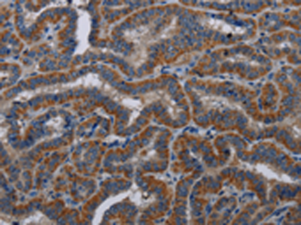 Rabbit Polyclonal Antibody to KLK11