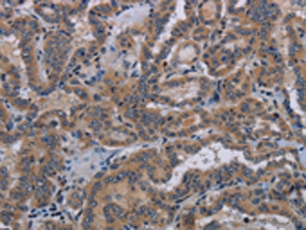 Rabbit Polyclonal Antibody to KLK8