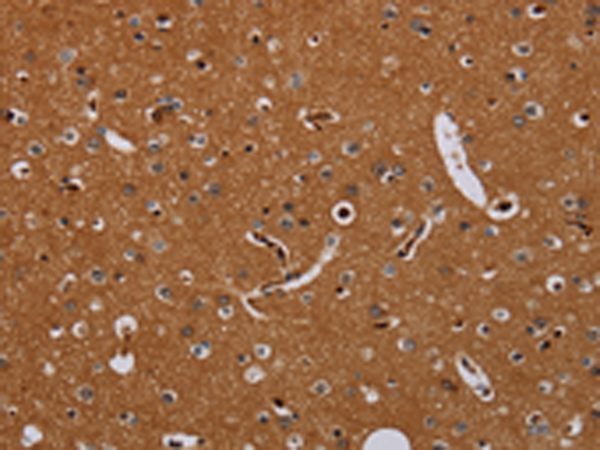 Rabbit Polyclonal Antibody to KLK13