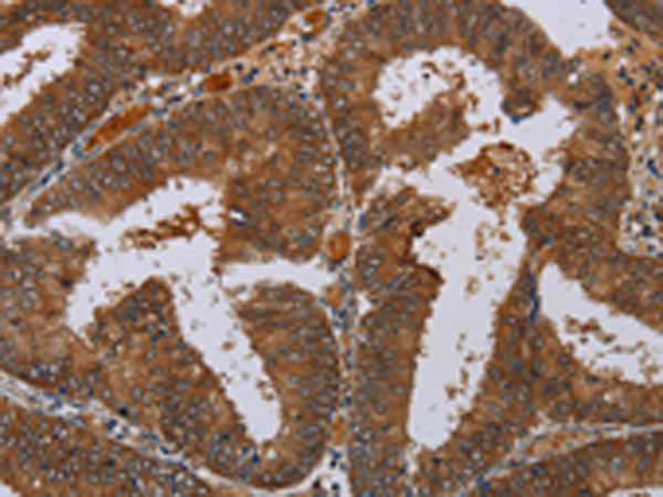 Rabbit Polyclonal Antibody to LCMT1