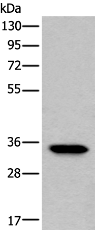 Rabbit Polyclonal Antibody to LDHC