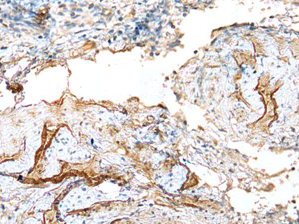 Rabbit Polyclonal Antibody to LDHD